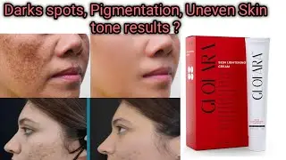 Glofara Cream Review | Dark Spots & Pigmentation Removal | Price, Uses & Results
