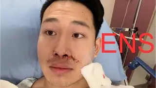 Septoplasty and Turbinate Reduction 2 Month Recovery and Review
