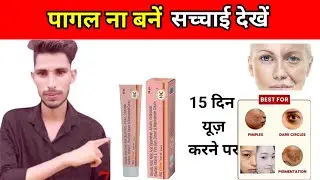ng glow cream review in hindi,gora hone wala cream,ng glow cream,uses 