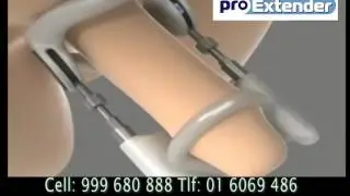 Pro extender - Alargamiento Viril - WhatsApp +51 999 680 888