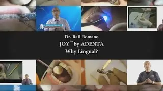 Dr. Rafi Romano - JOY by ADENTA - why lingual?