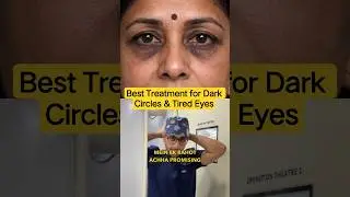 Promising Treatment For Under Eye Dark Circles- Blepharoplasty! | Dr DC, Plastic Surgeon