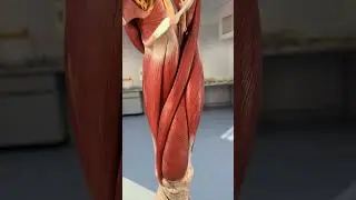 ANSWER IN THE COMMENTS #anatomy #medicine #quiz #physio