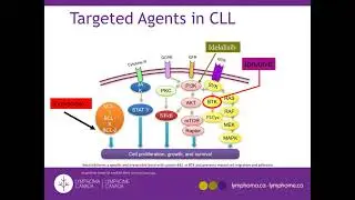 Lymphoma Research Highlights from ASH 2020