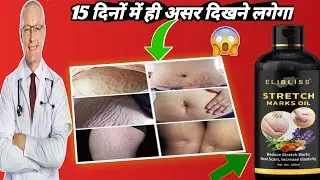 ELIBLISS STRETCH MARKS Oil Review For Reduce Stretch Marks Heal Scars Results in 15 days🤯🤯