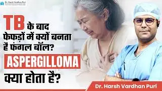 TB के बाद फेफड़ों में क्यों बनती है खाली जगह? | Aspergilloma (Fungal Ball) | Dr. Harsh Vardhan Puri