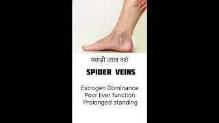 Feet show which part of your body having issues👣 |healthy tips| |feet| |amazing facts| |viral tips|