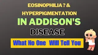 Adrenal Insufficiency: Causes, Symptoms And Tests | Adrenal Insufficiency, What No One Will Tell You