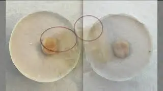 GIC and Occlusal Forces short