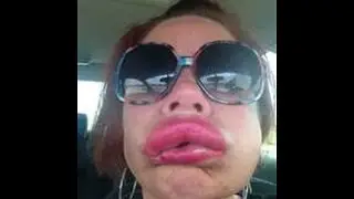 ALLERGIC TO MAKEUP and SHELLFISH
