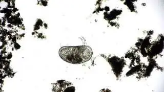 🔬 Muschelkrebs - Ostrakode - ostracode under the microscope in Full HD