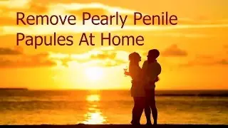 How To Remove Pearly Penile Papules At Home Naturally - Pearly Penile Papules Treatment
