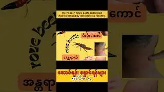 Don&rsquo;t Touch This Insect! ⚠️ The Truth About Rove Beetle Burn. Part-1 #healthtips #foryou #shortsfeed