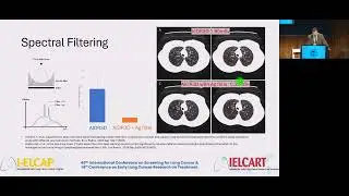 03c   Next Generation of CT Radiation Dose Reduction