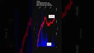 TMDX, TransMedics Group, Inc., 2024-04-05, stock prices dynamics, stock of the day