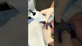 Quick Dental Scan for Retainer Fitting