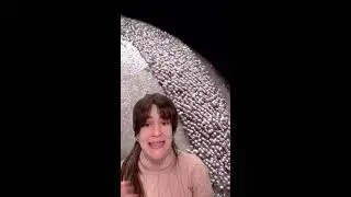 Transplante Capilar - Consulta Totalmente Gratis