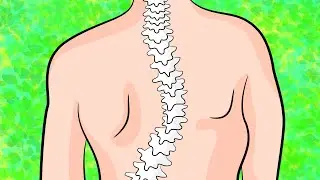 Как избавиться от сколиоза верхней части спины за 4 минуты в день