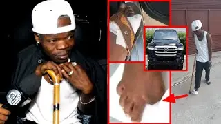 HARMORAPA akatwa vidole zimbabwe - GARI aliyonunua sasa ITAKUSHANGAZA