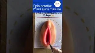Tutorial Episiorrafia: Primer plano mucosa vaginal.