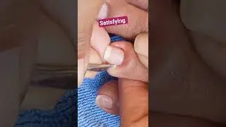 Truly satisfying dry skin relief #satisfying #nails
