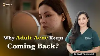 Causes of Adult acne | Acne on face ! Skin Doctor in Hyderabad