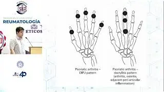 Presentación de casos Clínicos Reumatología
