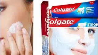 Best Toothpaste Beauty Hacks for Skin Problems | Beauty Benefits of Toothpaste #youtube #trending