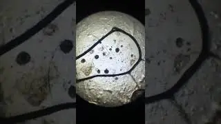 Scabies - Veterinary Video
