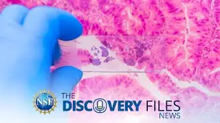 AI Searches for Breast Cancer 🎗#science #news #breastcancer #cancer