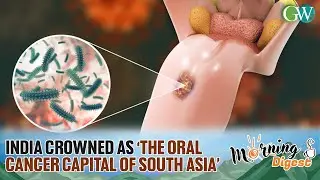 INDIA HAS THE LARGEST NUMBER OF ORAL CANCER CASES CAUSED BY SMOKELESS TOBACCO
