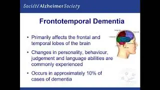An Overview of Alzheimer's Disease and Dementia
