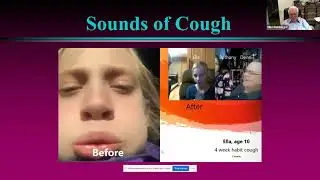 Prof Miles Weinberger Functional Respiratory disorders in Children Feb 2021