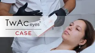How to rejuvenate the eye area with TwAc Eyes | PDRN injectable treatment
