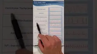 👆 Click Above to Watch Full Video 👆