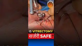 Is Vitrectomy Surgery Safe?