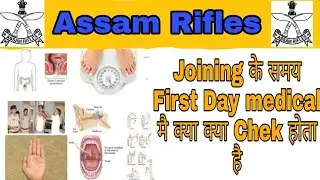 Assam Rifles Joining के First Day medical मै क्या क्या Chek किया जाता है