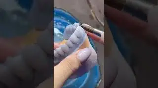La Odontolog&iacute;a Est&eacute;tica Comienza en un Laboratorio Dental