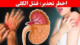 ٧ علامات خطيرة في جسمك تدل على أن كليتيك تستغيثان طلباً للمساعدة