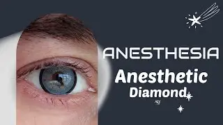Anesthesia - Anesthetic Diamond &Ccedil;OK FARKLI BİR LENS! #viral #eyeschallenge #renklilens