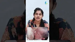 Breast Abscess Explained: What You Need to Know by Dr. Malavika | Breast infection