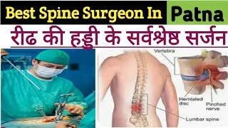 Best Spine Surgeon In Patna | Best Orthopedic In Patna | jvd orbit