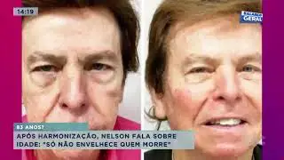 Ap&oacute;s harmoniza&ccedil;&atilde;o Nelson Rubens fala sobre idade: 