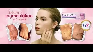 Fair & Clear Treatment of Freckles Cream 100 % working //// White Glow HD