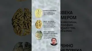 Как восстановить работу мозга после ал*голя? #здоровье #мозг #биохакинг #нейробиология #наука