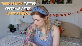 3rd Session: Tattoo Cover-Up After Laser Tattoo Removal