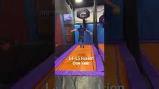 Trampoline after Back Surgery?? #backpain #inspiration #health