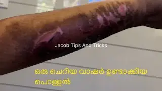 Regulator Washer Complaint കാരണം തീ പിടിച്ചു ⚠️ | Gas Cylinder Danger