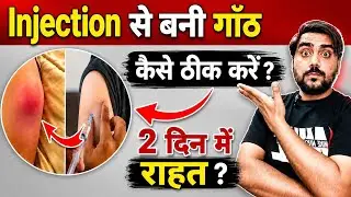 Injection से बनी गांठ 🔥 को कैसे ठीक करे | injection ki ganth ka ilaj | injection ki ganth ka ilaaj