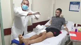 Fisioterapia no pós operatório de fratura da diafise do fêmur
